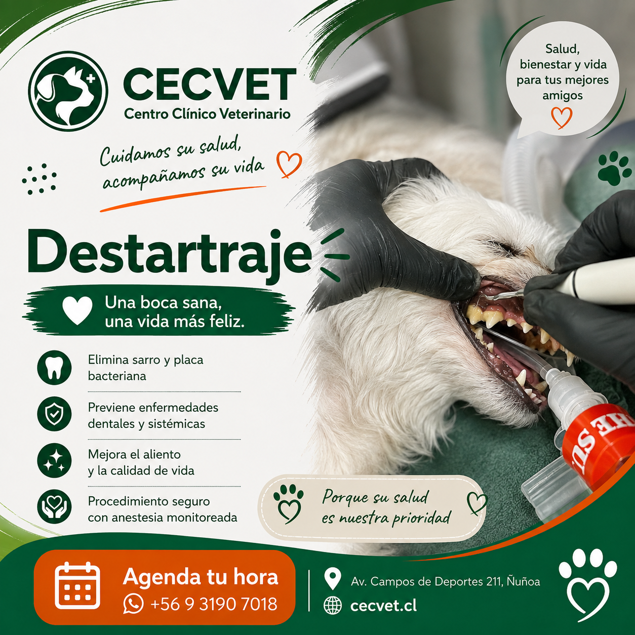 Destartraje